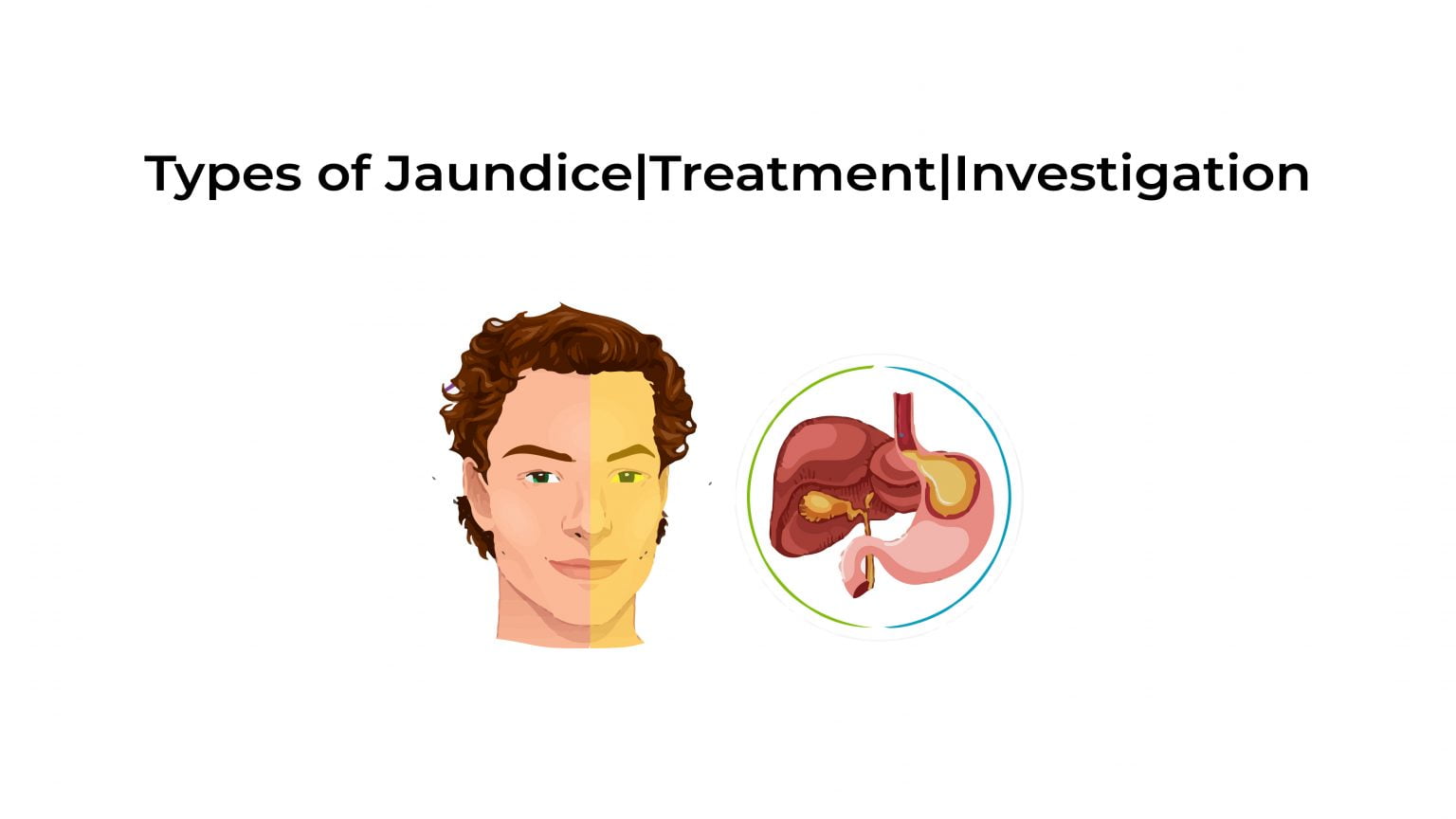 Types of Jaundice Treatment Investigation Stat! Cardiologist