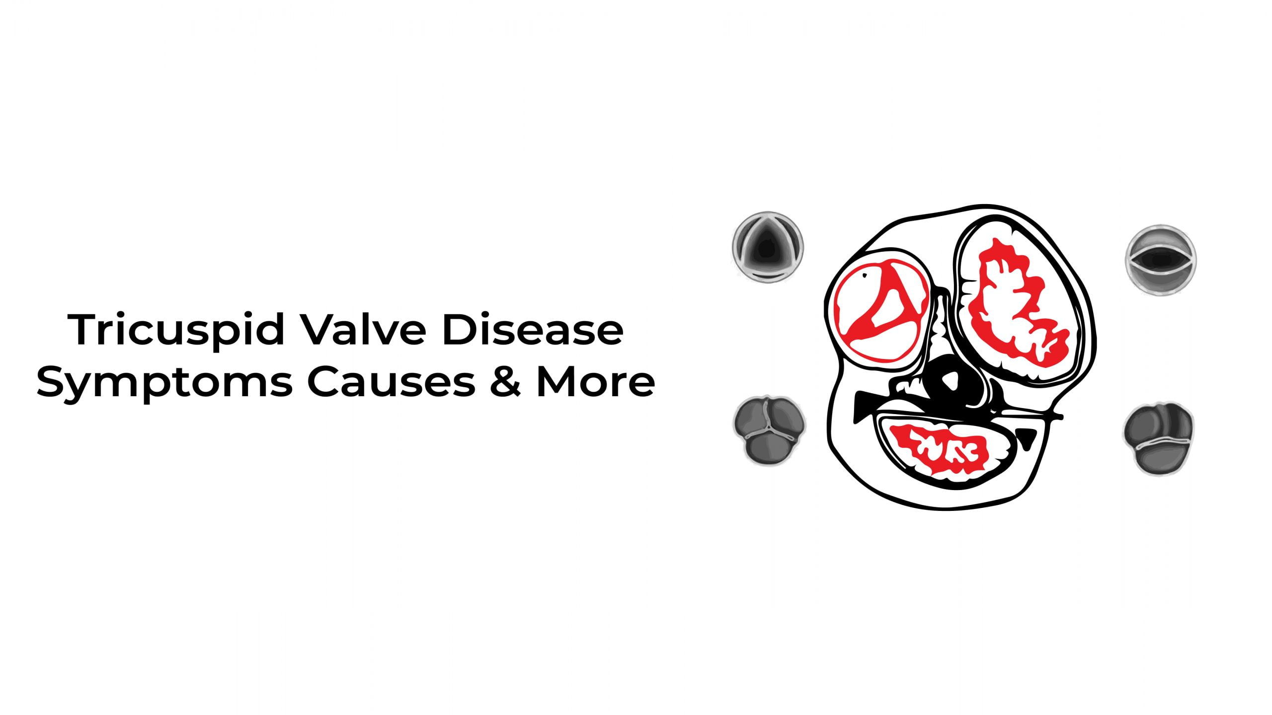 tricuspid-valve-disease-symptoms-cause-more-statcardiologist