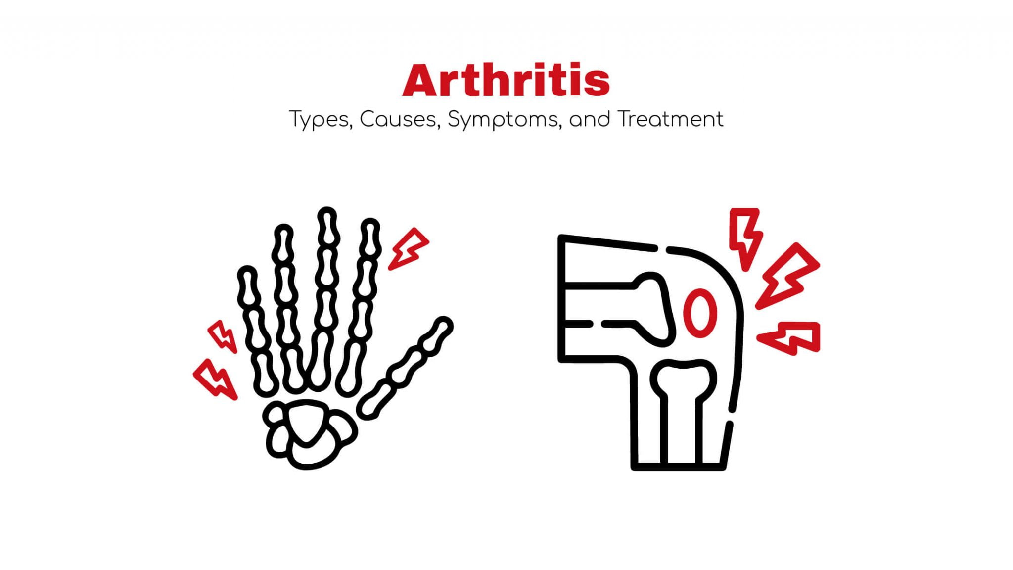 Arthritis: Types,Causes,Symptoms, & Treatment ~ Stat! cardiologist