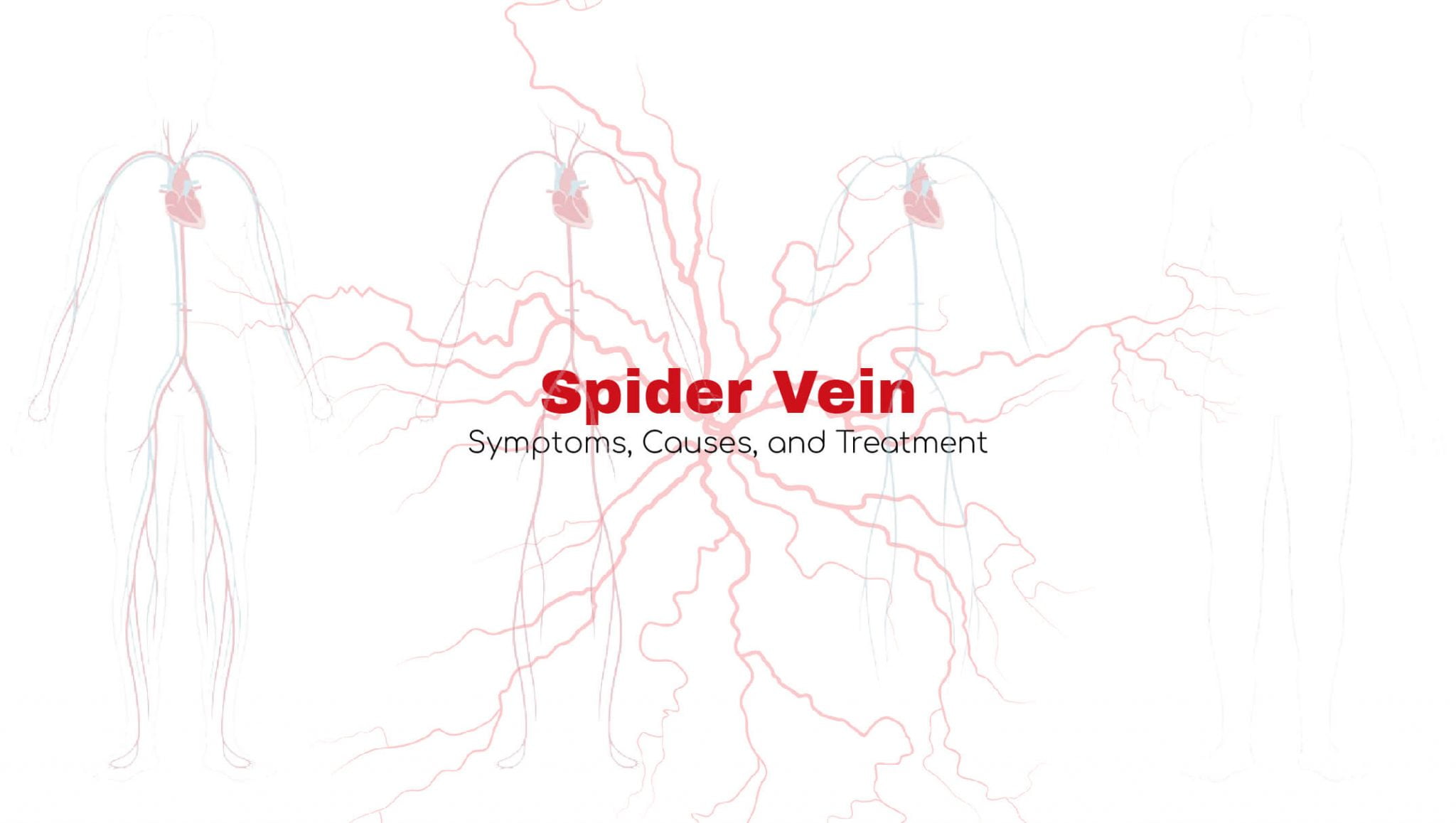 Spider Veins Symptoms, Causes, and Treatment Stat! Cardiologist