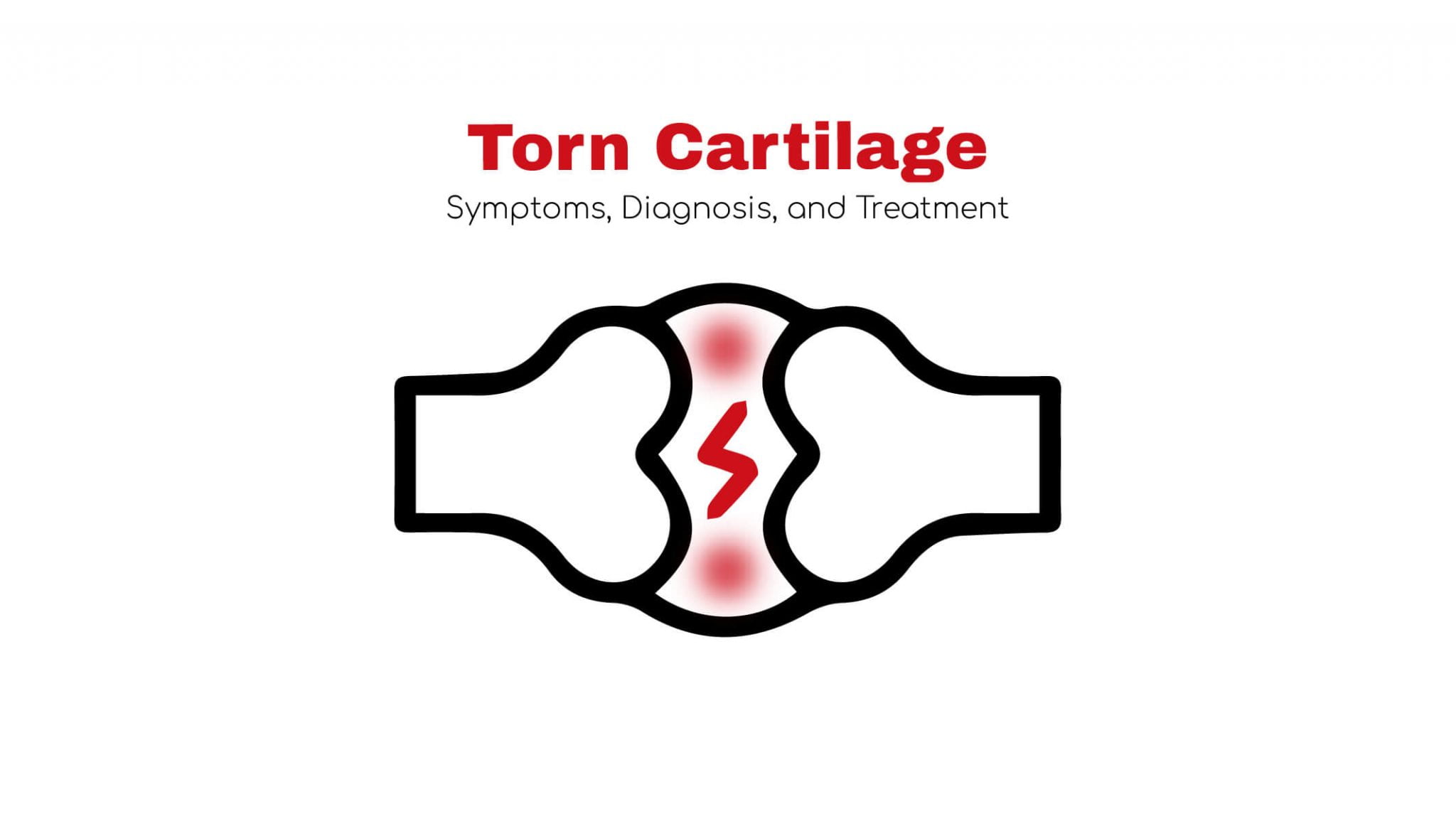 Torn Cartilage Symptom Causes Andtreatment Stat Cardiologist