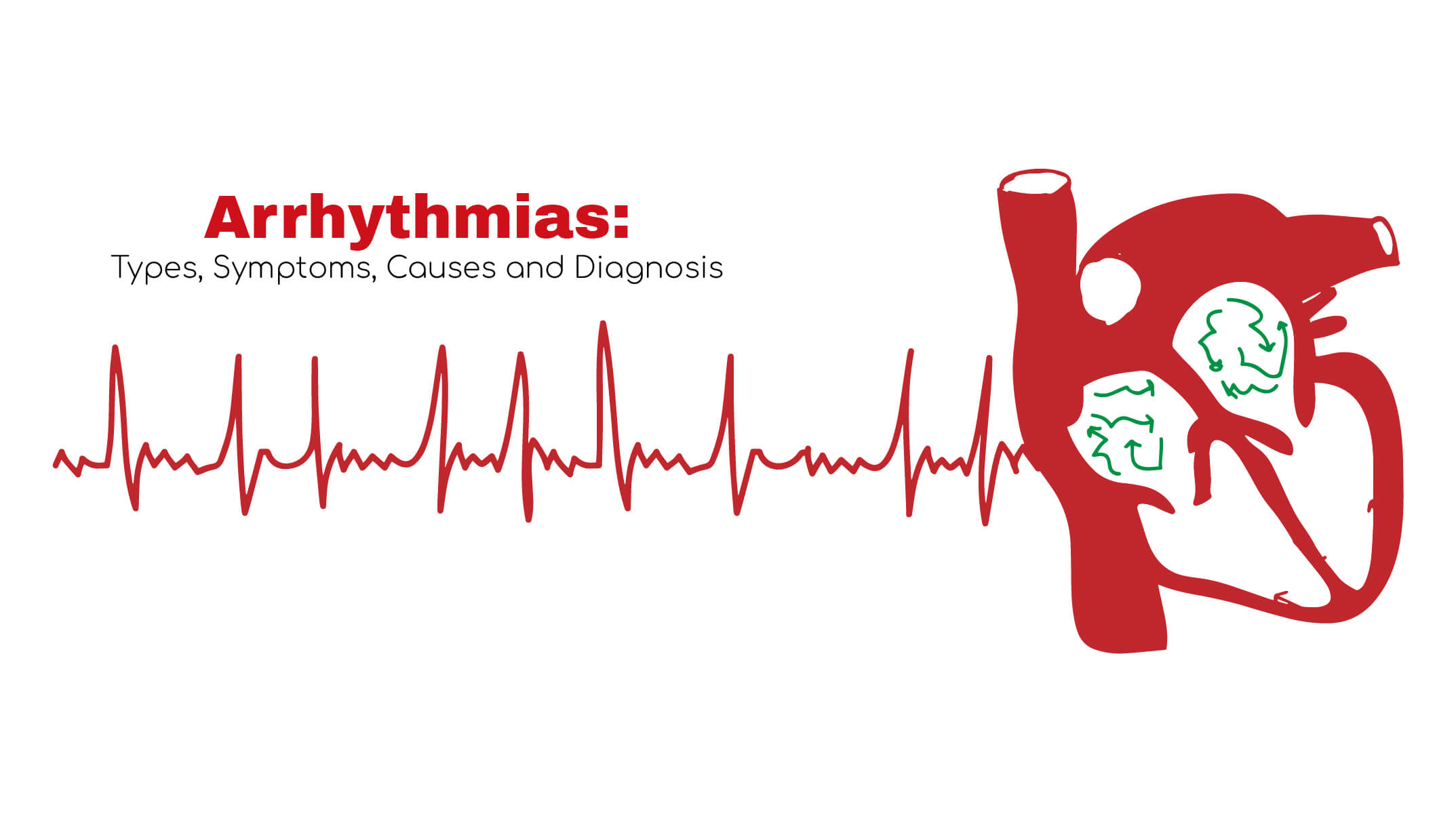 Arrhythmia Types, Symptoms, Causes and Diagnosis Stat! Cardiologist