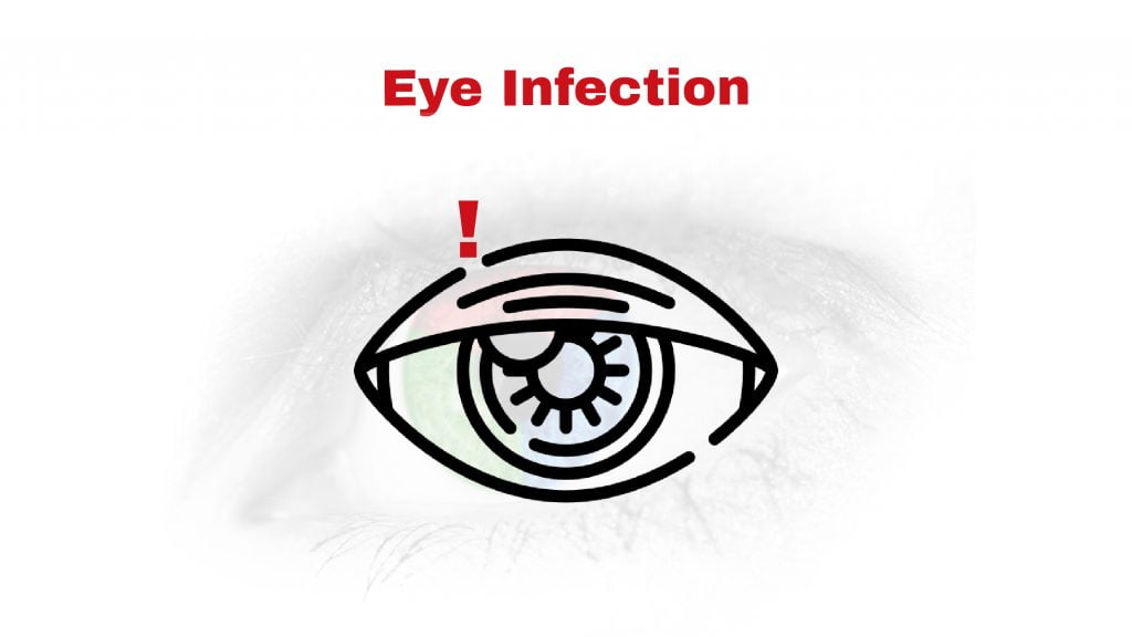 Eye infections Archives Heart Doctor Cardiologist and Internal