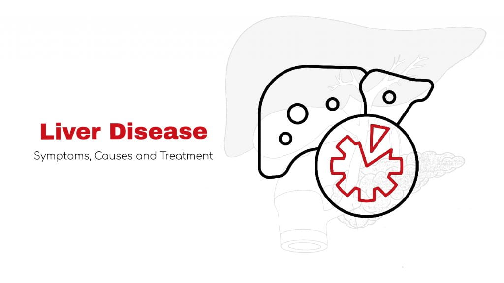 Liver Disease Symptoms, Causes and Treatment Statcardiologist