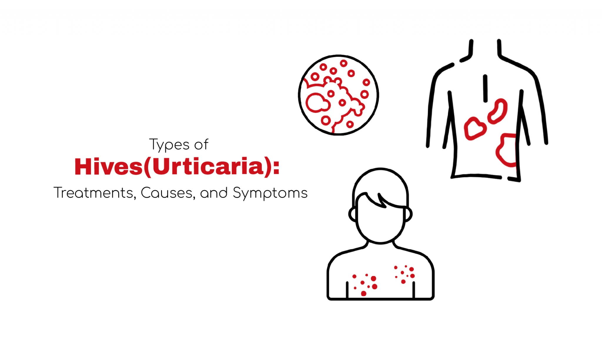 types-of-hives-treatments-and-causes-stat-cardiologist