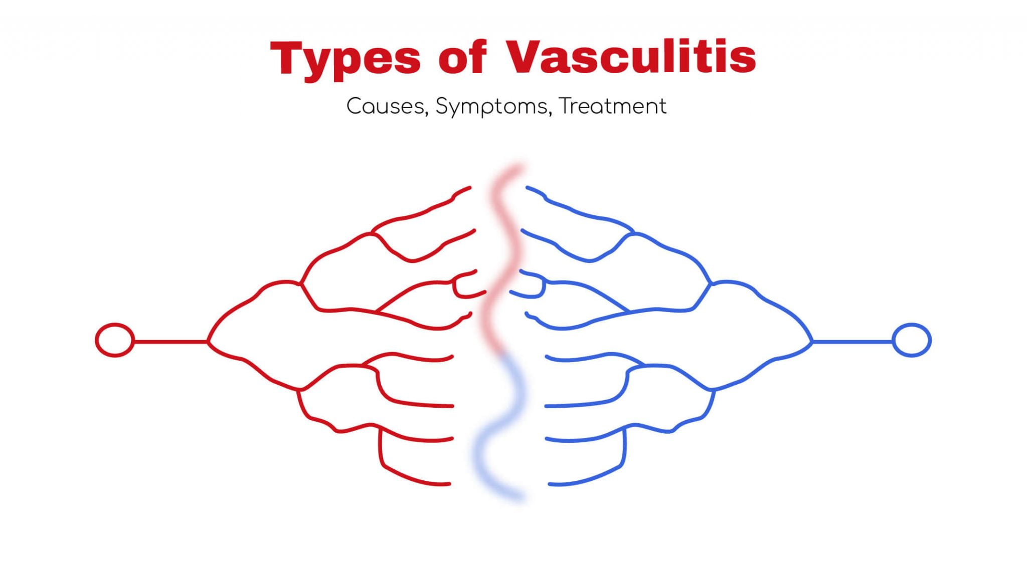 Types of Vasculitis, Symptoms, Treatment StatCardiologist