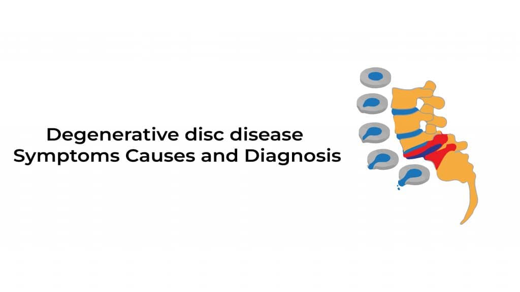 Degenerative disc disease Stat Cardiologist