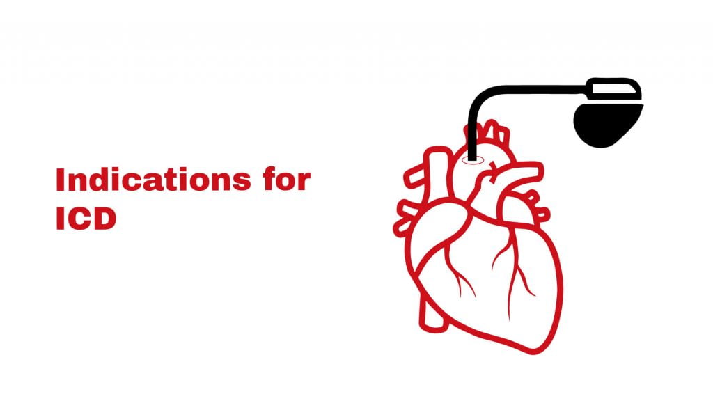 Indications for ICD ~ Stat Cardiologist