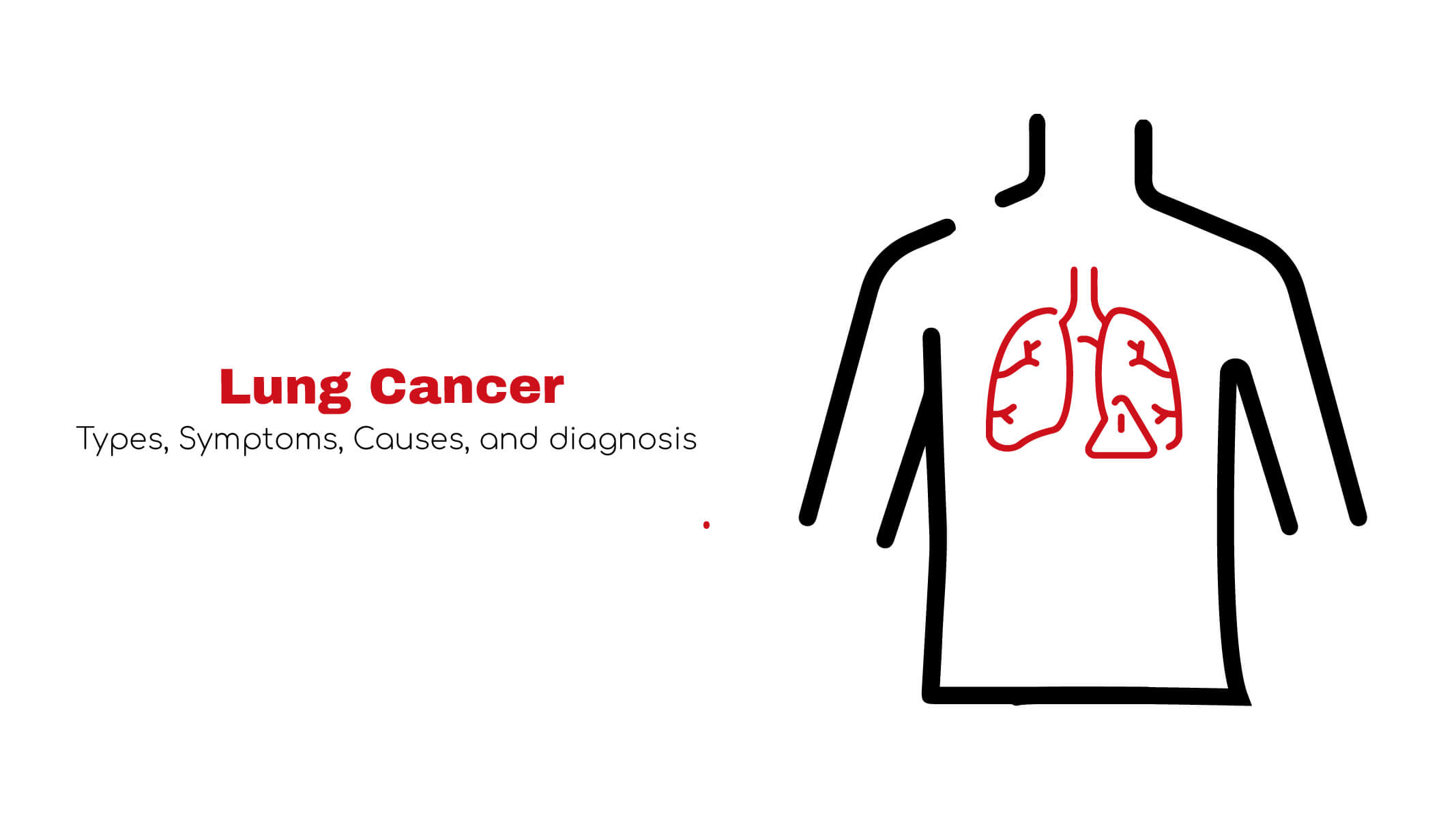 Lung Cancer ~ Statcardiology 9233