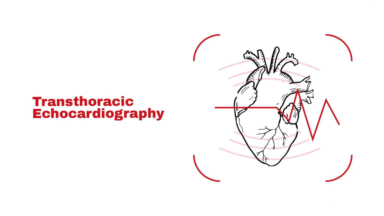 Transthoracic Echocardiography Stat Cardiologist