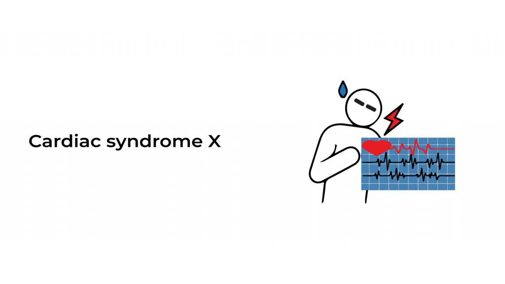 Cardiac syndrome X Stat Cardiologist