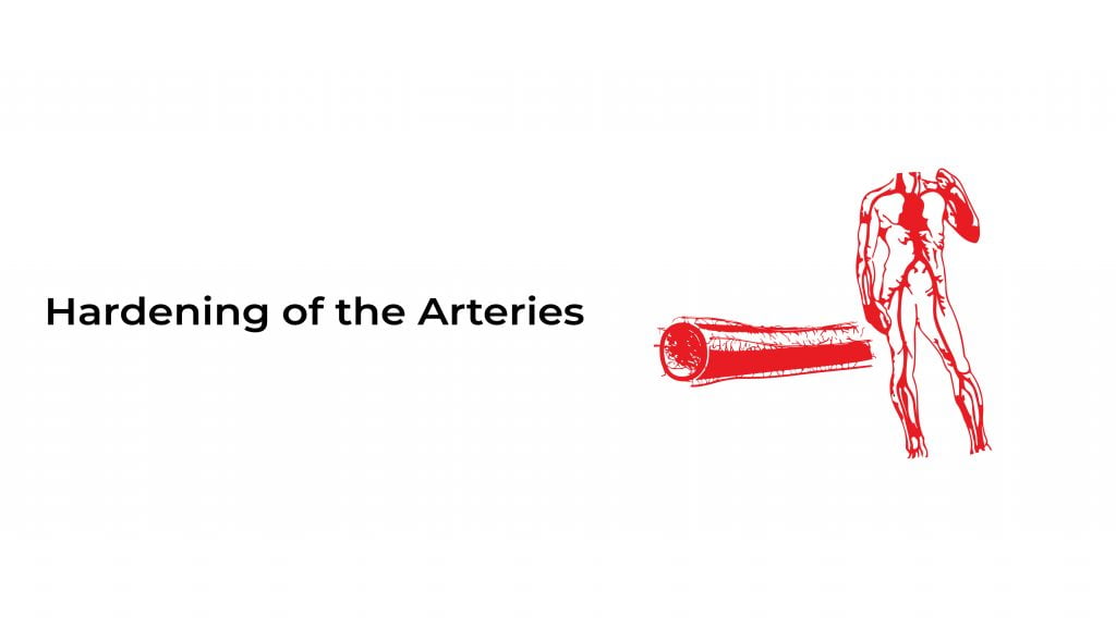 Hardening of the arteries stat cardiologist