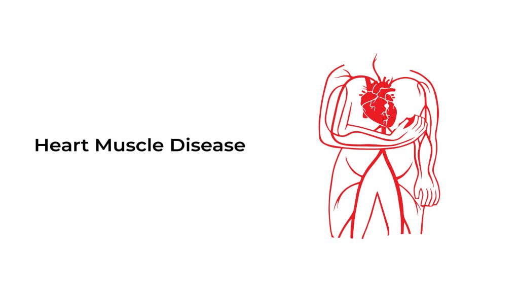 disease of the heart muscle