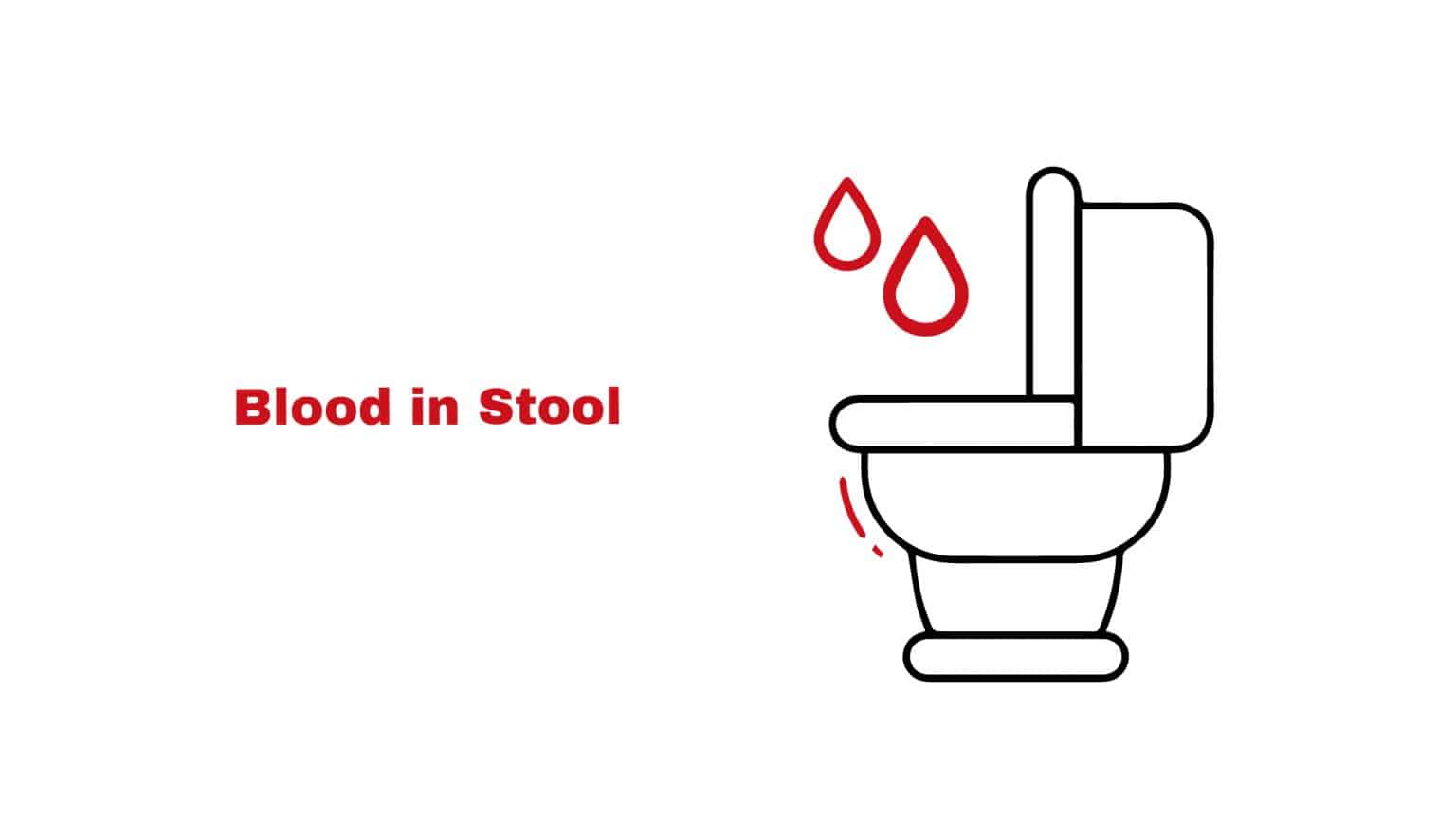 Blood in Stool Stat Cardiologist