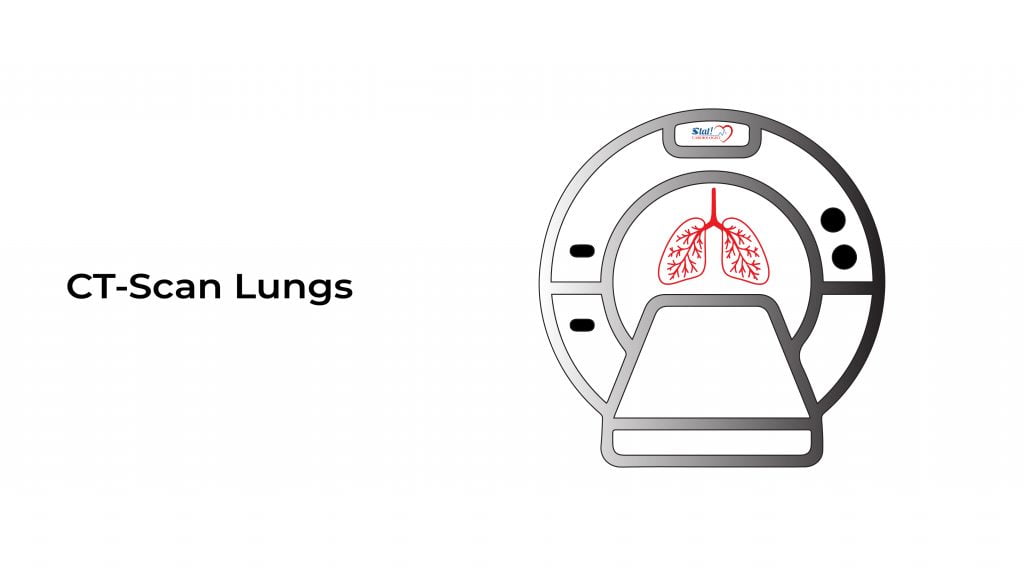 ct-scan-lungs-stat-cardiologist