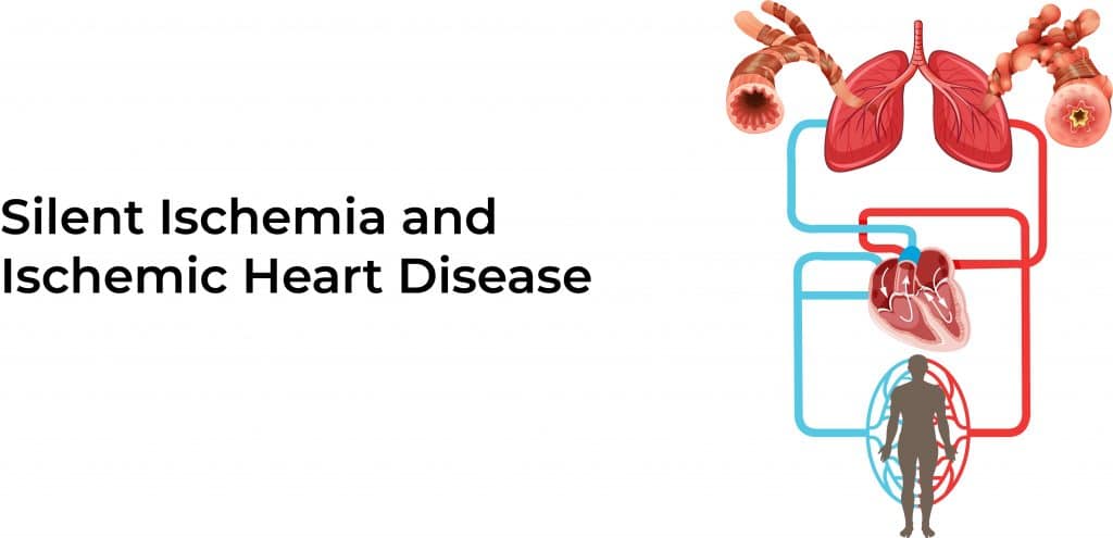 silent-ischemia-stat-cardiologist