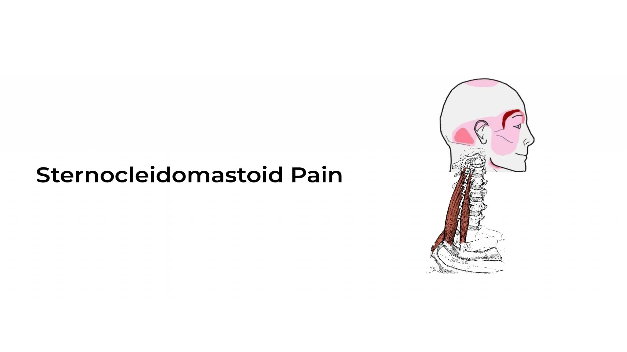 sternocleidomastoid-pain-stat-cardiologist